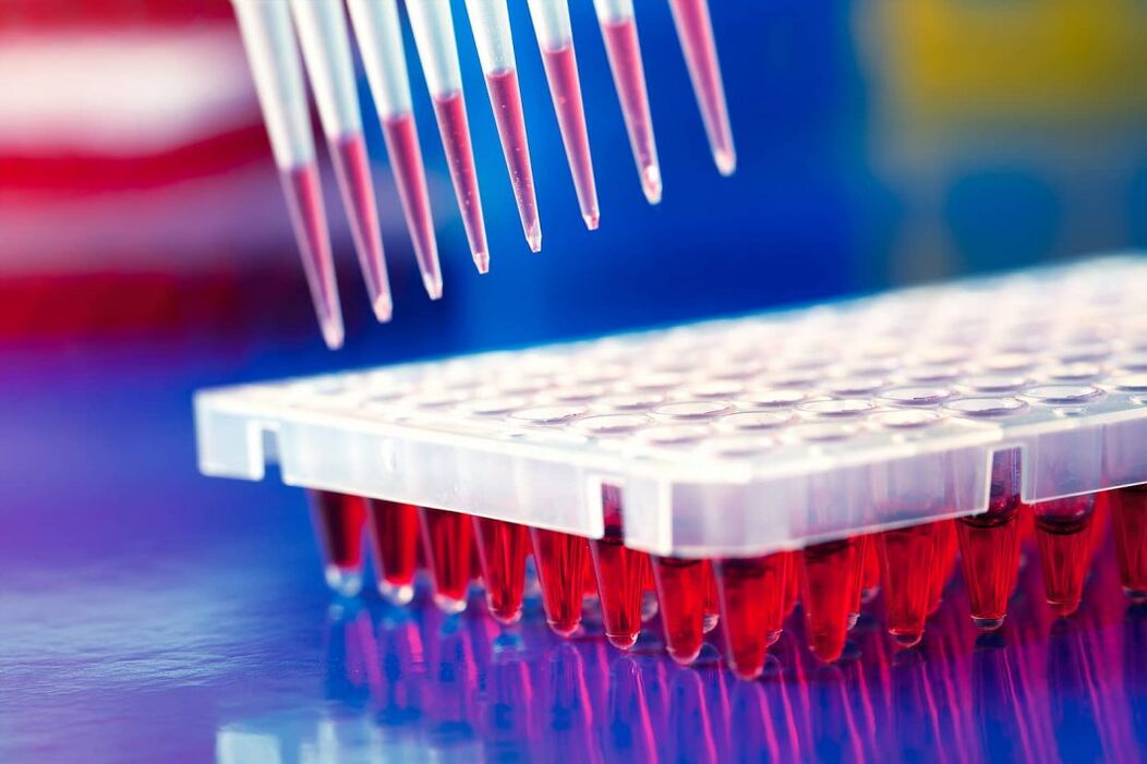 Parasite Immunoassay Blood Test