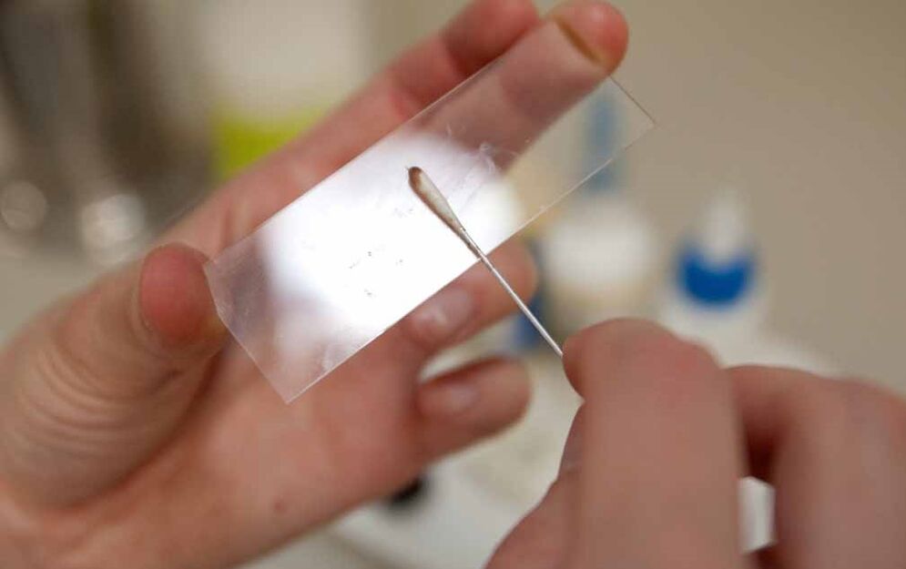 Scrape to see if parasites are present in the body