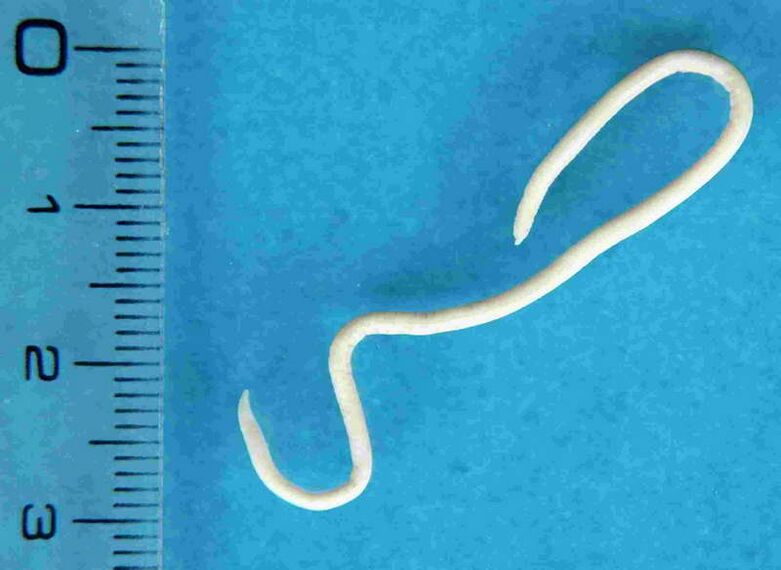 worms from human body