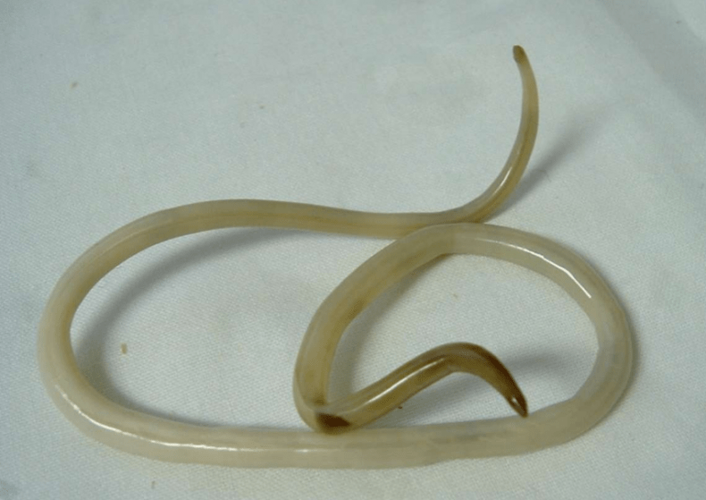 Human worms and their treatment