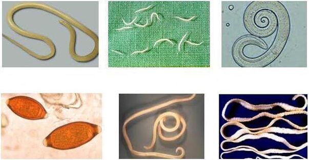 Worms that can infect humans